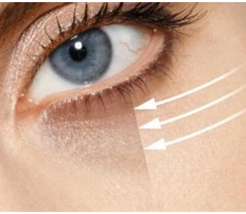 Duzzadt, karikás szem